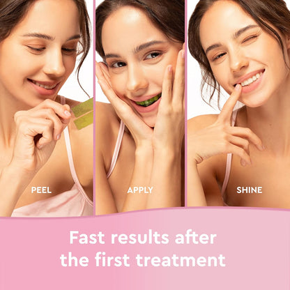 WHITRNING STRIPS -Strisce professionali